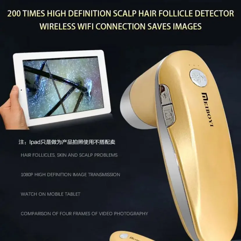 Цифровые волосы Скальп 200 Раз С программным обеспечением Gy 9822U Анализатор Косметический аппарат Микроскоп